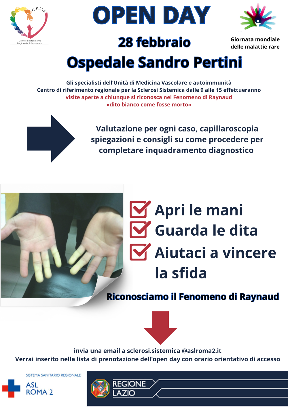 Anteprima